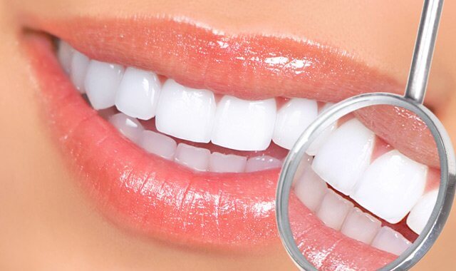 poznań ortodonta wybielone zęby